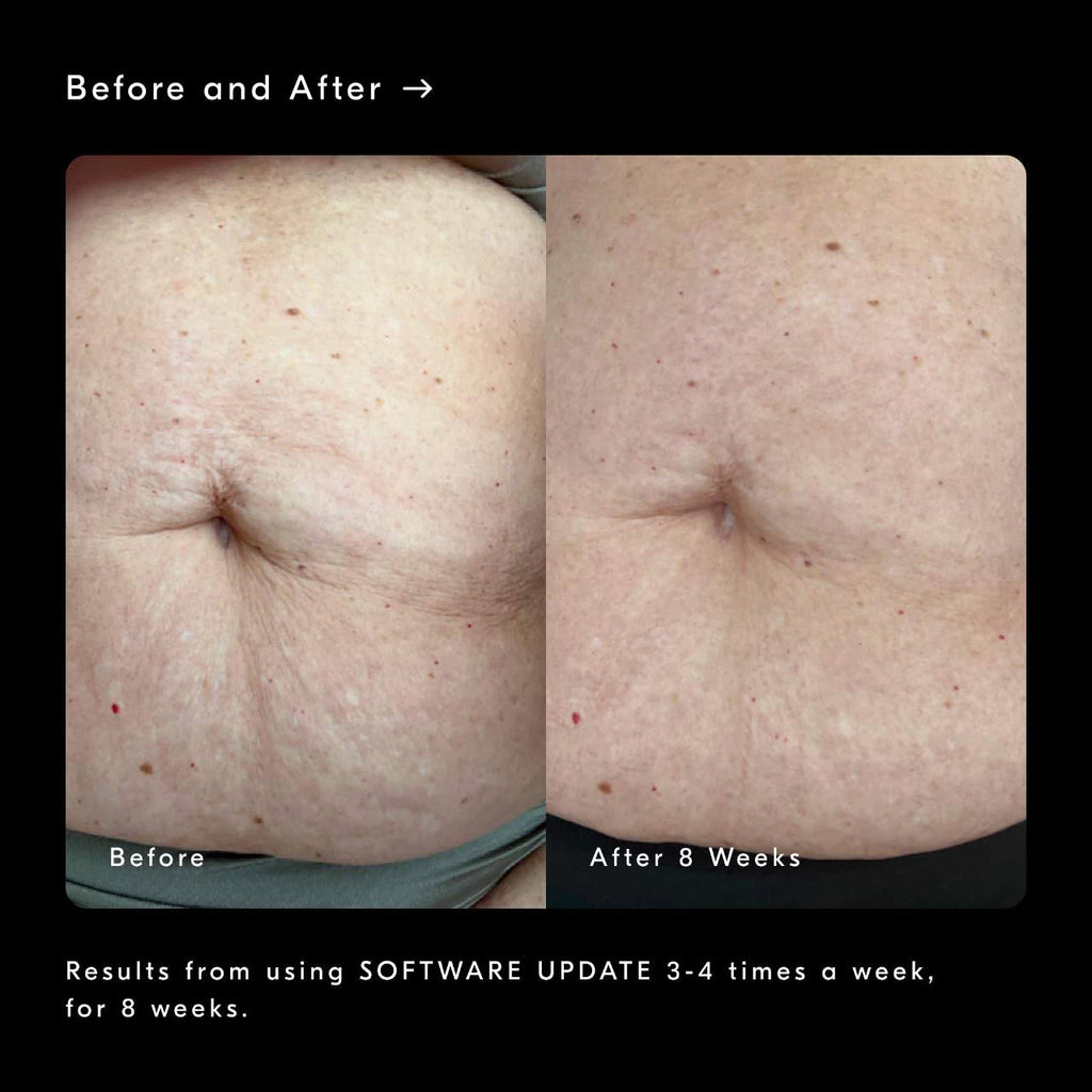 Software Update Retinol Body Serum