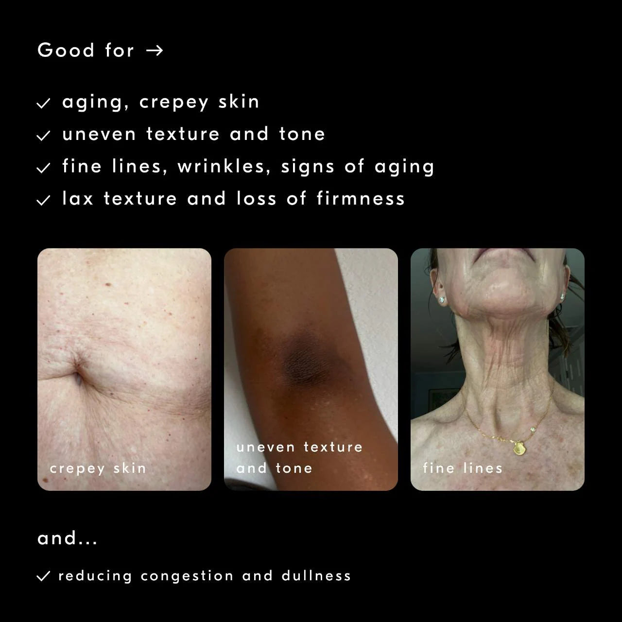Software Update Retinol Body Serum