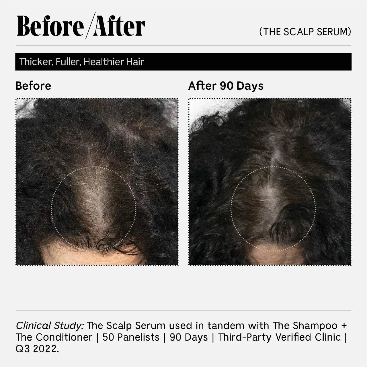 The Scalp Serum