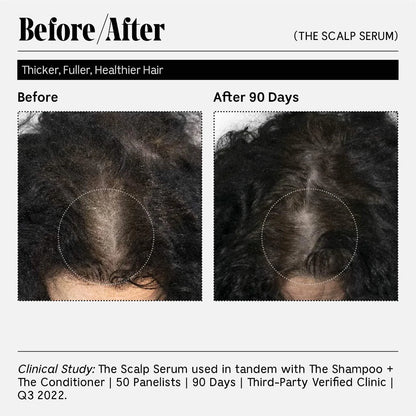 The Scalp Serum