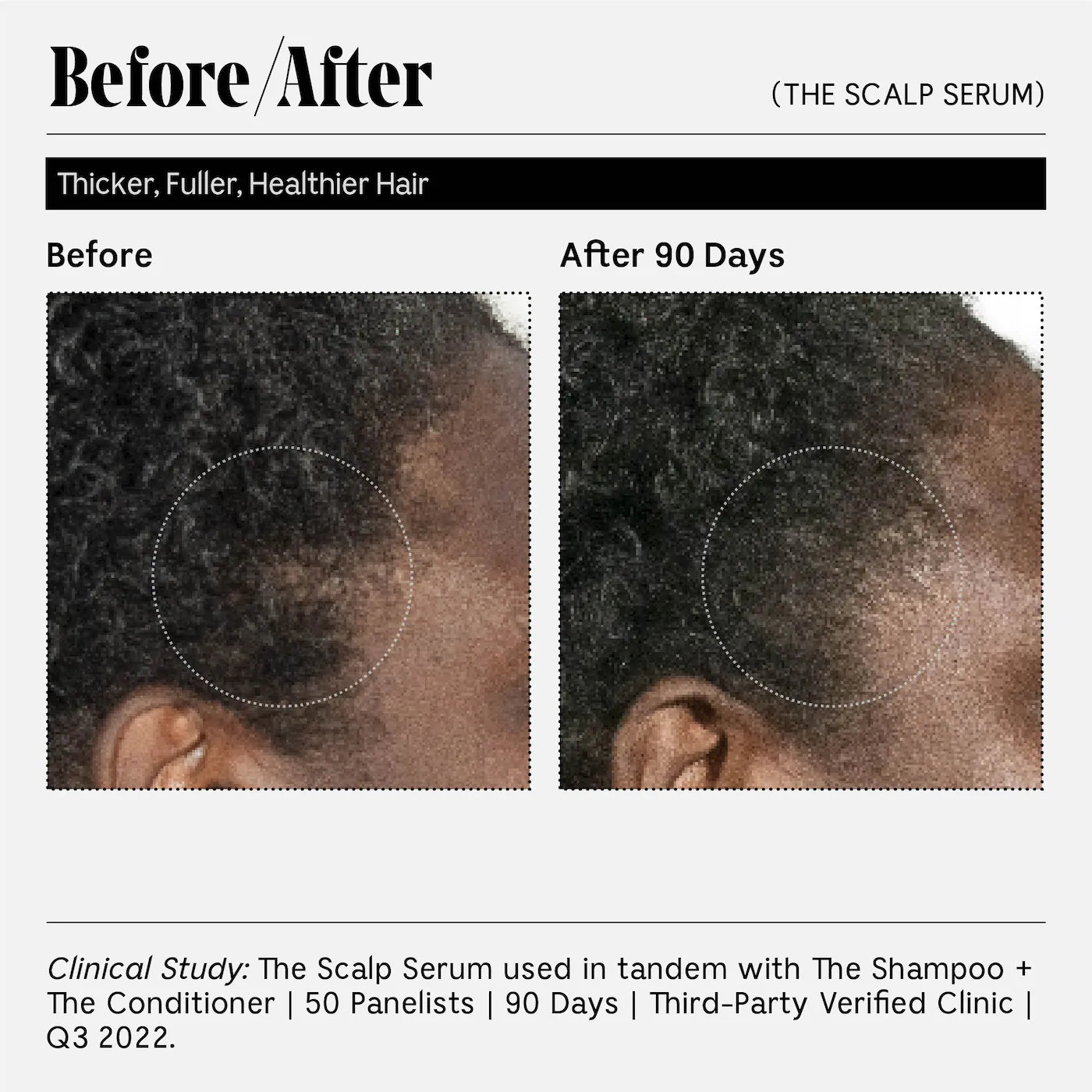 The Scalp Serum