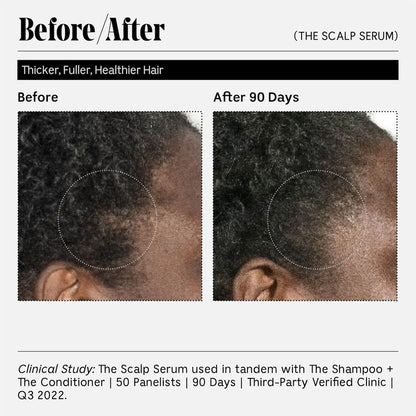 The Scalp Serum