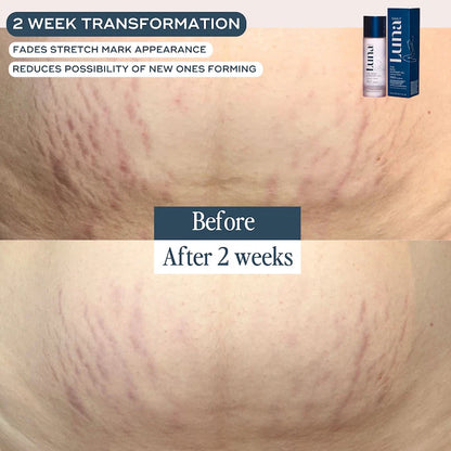 The Skin Support Oil