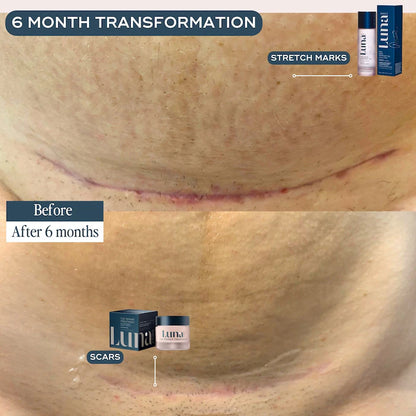 The Skin Support Oil