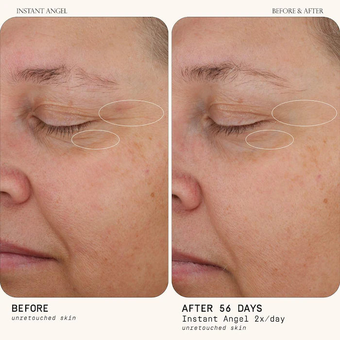 Instant Angel Barrier Repair