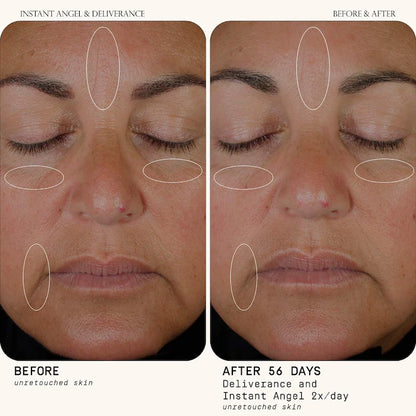 Instant Angel Barrier Repair
