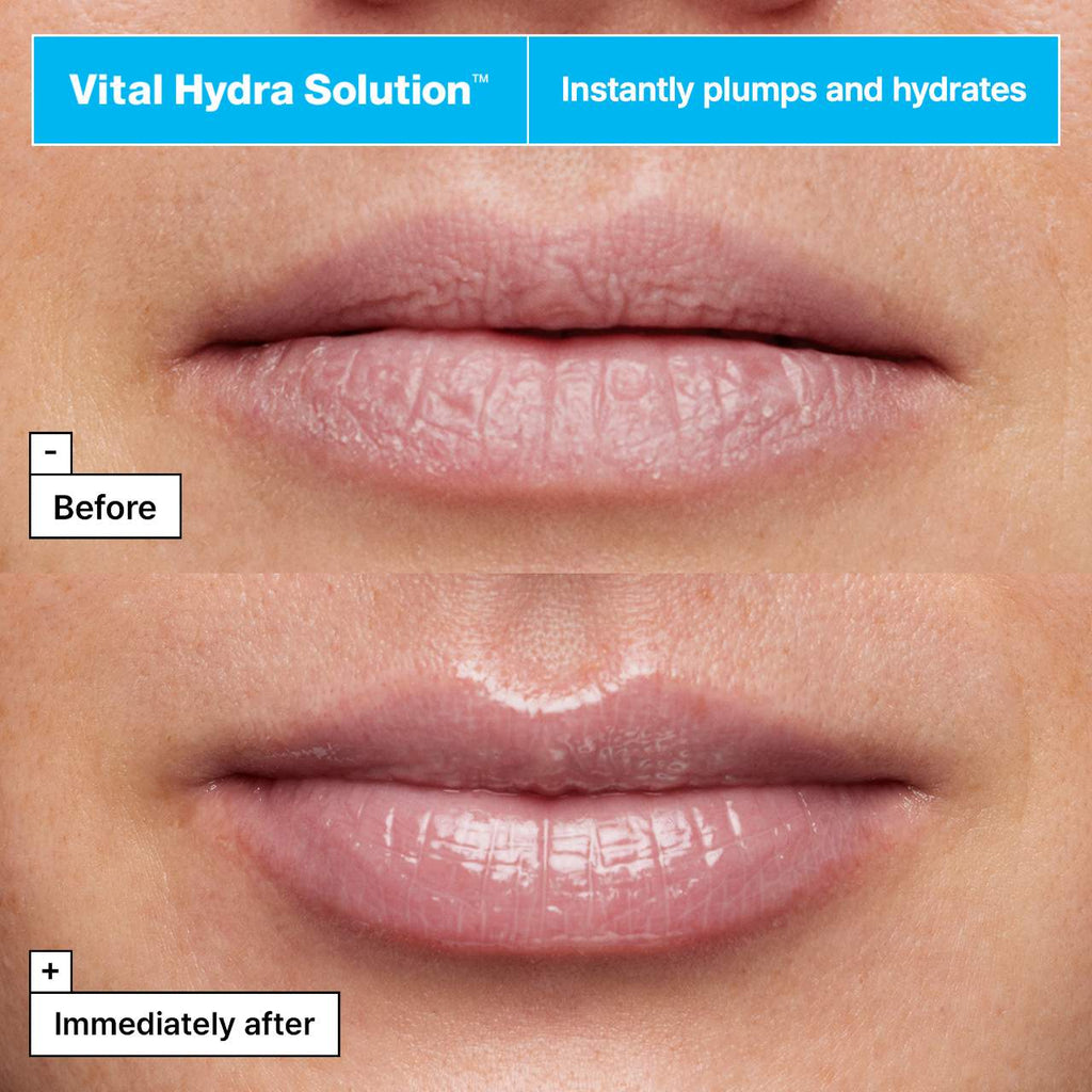 Vital Hydra Solution™ Jelly Bear Lip Mask