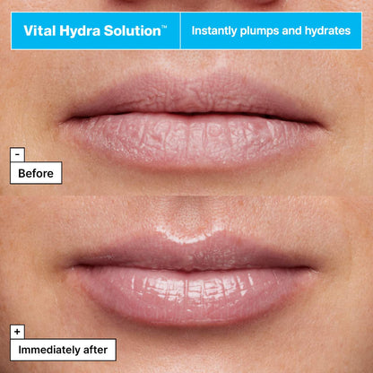Vital Hydra Solution™ Jelly Bear Lip Mask