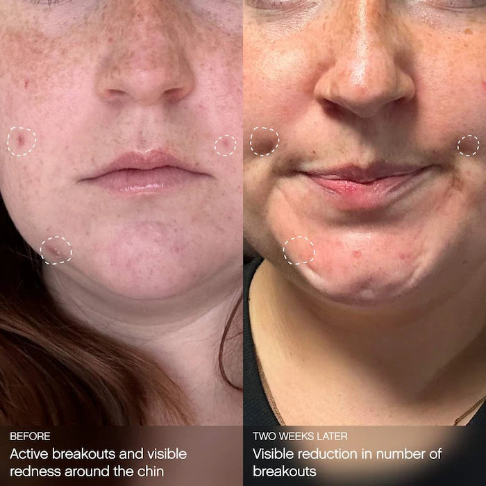 Clearly Clarifying & Calming Mask