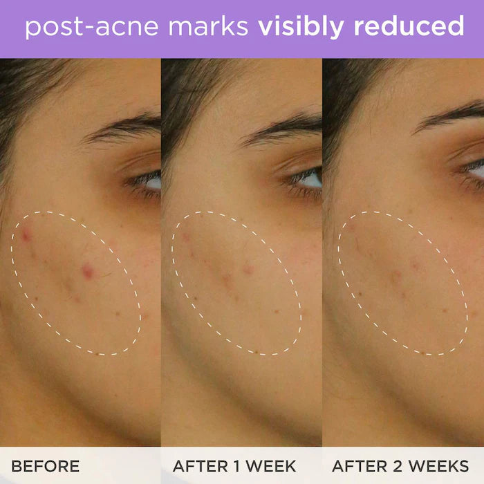The Brightening Serum