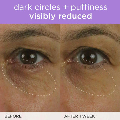 The Brightening Eye Cream