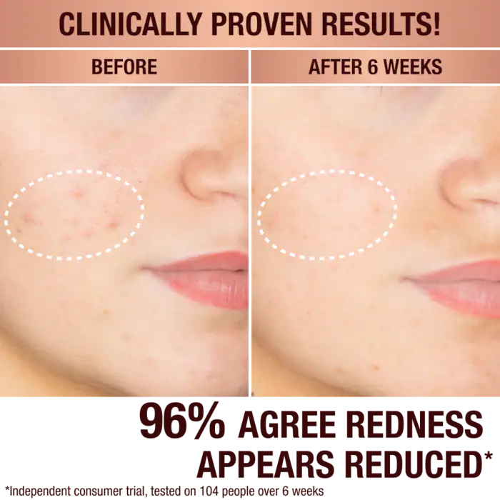 Dark Spot Correcting Radiance Recovery Serum