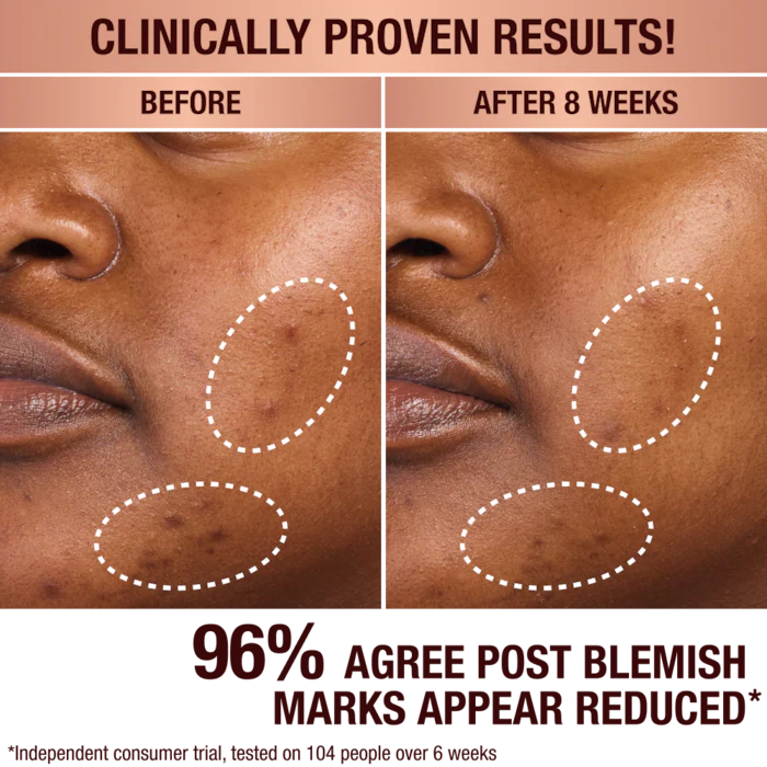 Dark Spot Correcting Radiance Recovery Serum