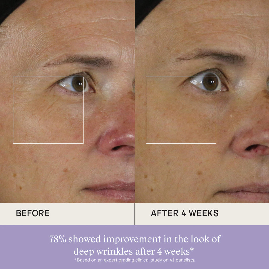 The Silk Serum Wrinkle-Smoothing Retinol Alternative