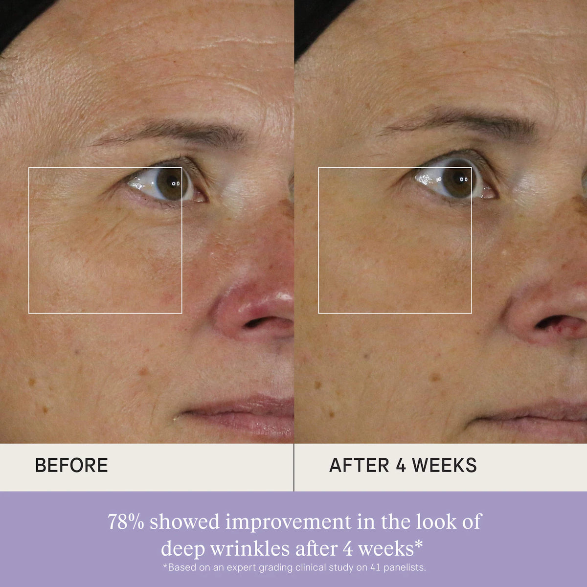 The Silk Serum Wrinkle-Smoothing Retinol Alternative