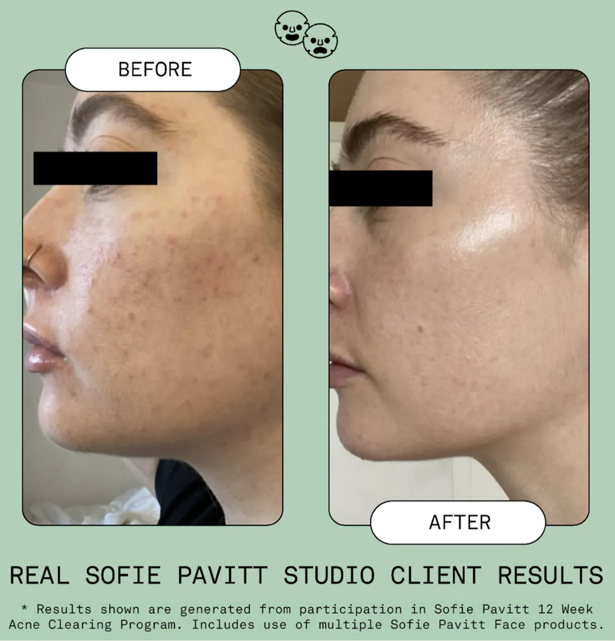 Nice Ice Frozen Cryo Rescue Treatment to Depuff and Calm Skin