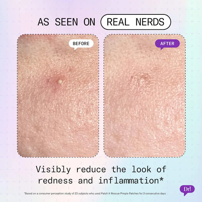 Patch It Pimple Patches