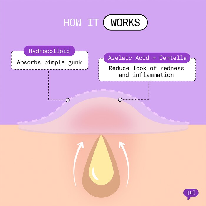 Patch It Pimple Patches