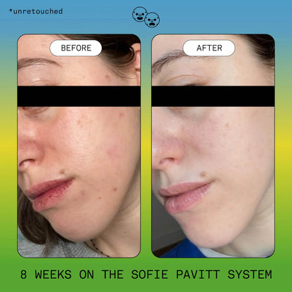 Clear Skin Trial Set: Cleanse, Treat, & Hydrate Minis Set