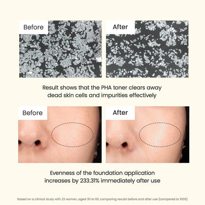 Skin Refining Mild PHA Toner with 8% PHA for Gentle Exfoliation