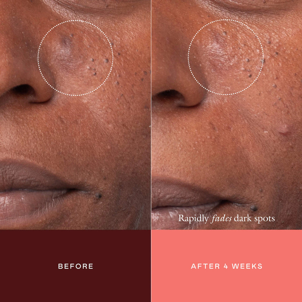 The Mark Advanced Targeted Dark Spot Concentrate
