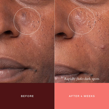 The Mark Advanced Targeted Dark Spot Concentrate