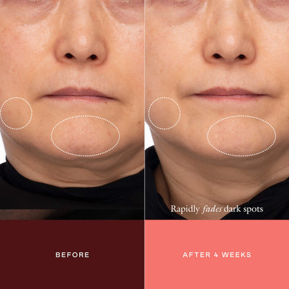 The Mark Advanced Targeted Dark Spot Concentrate