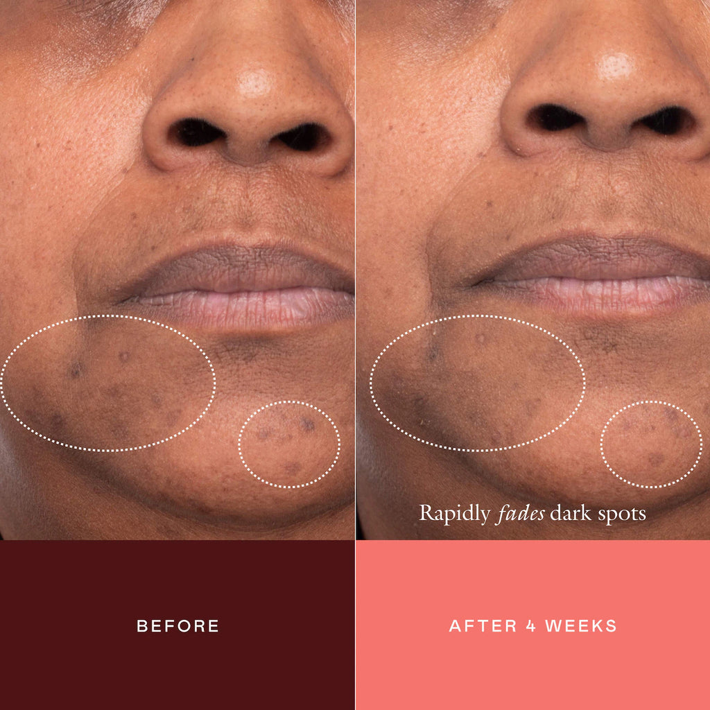 The Mark Advanced Targeted Dark Spot Concentrate