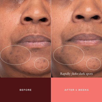 The Mark Advanced Targeted Dark Spot Concentrate