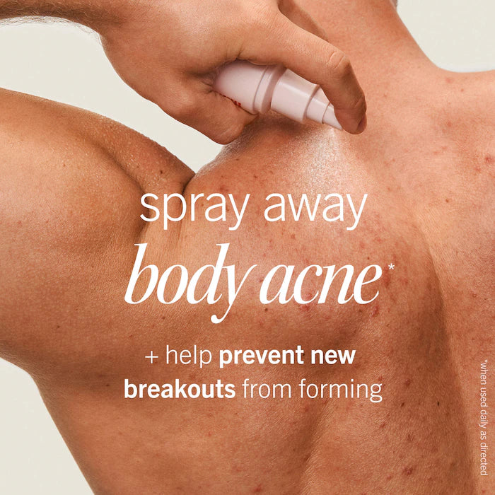 Body Acne Clearing Mist