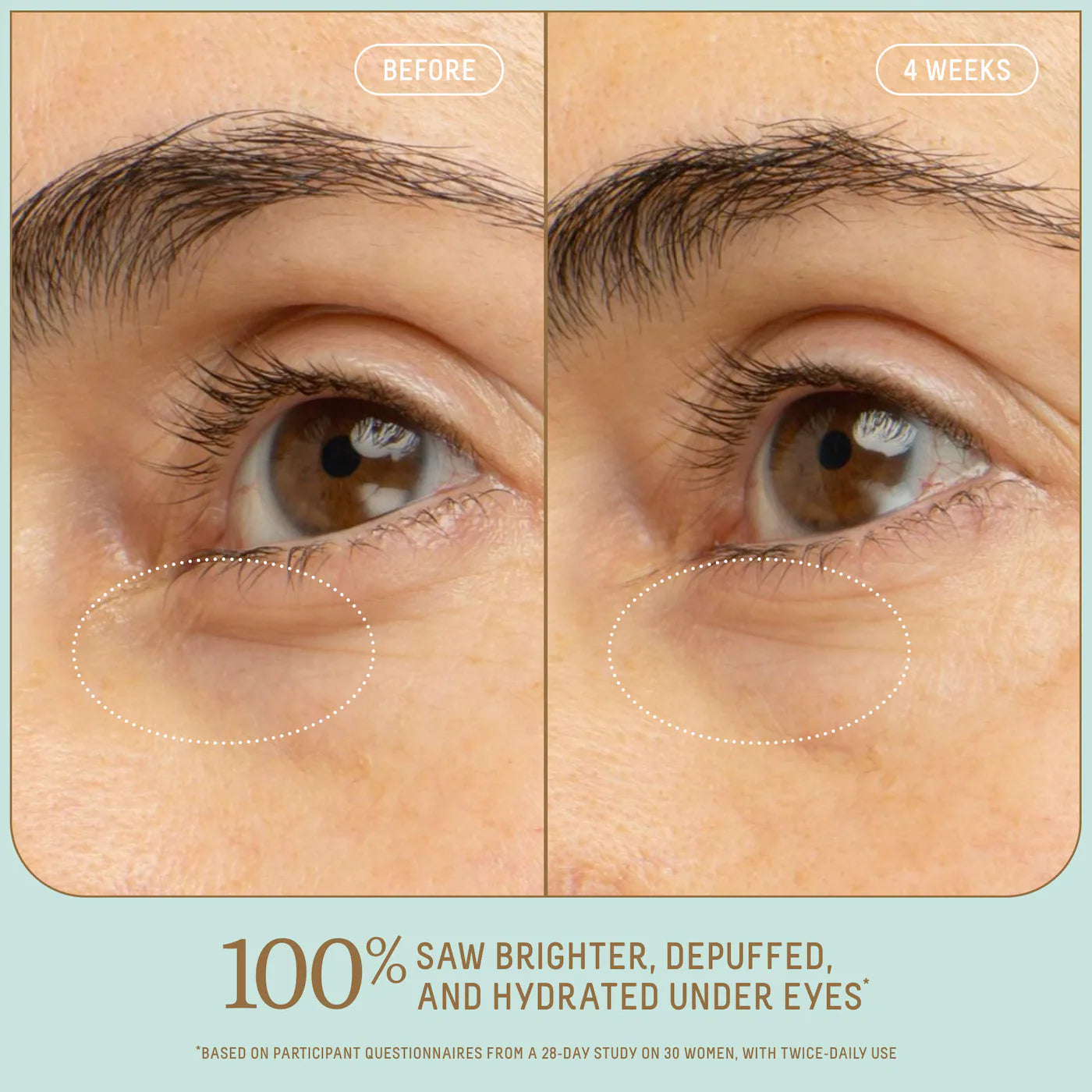 5% Niacinamide Brightening Eye Serum with Vitamin C + Squalane