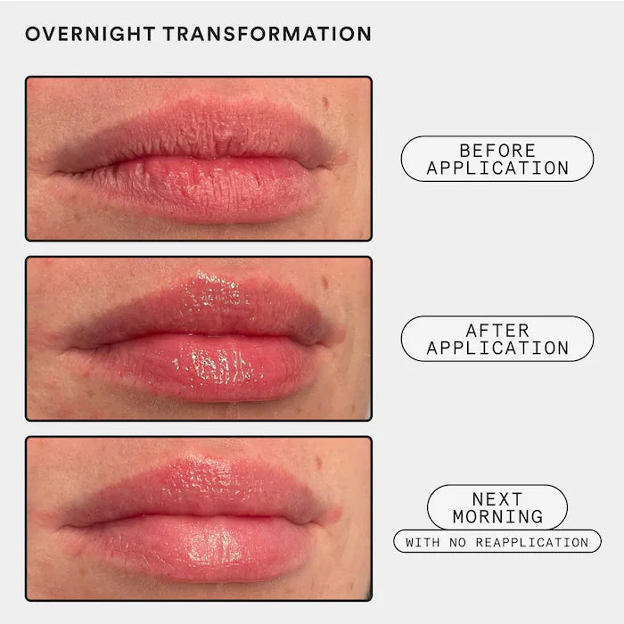 Softwear Lip Treatment