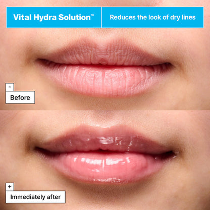 Vital Hydra Solution™ Jelly Bear Lip Mask