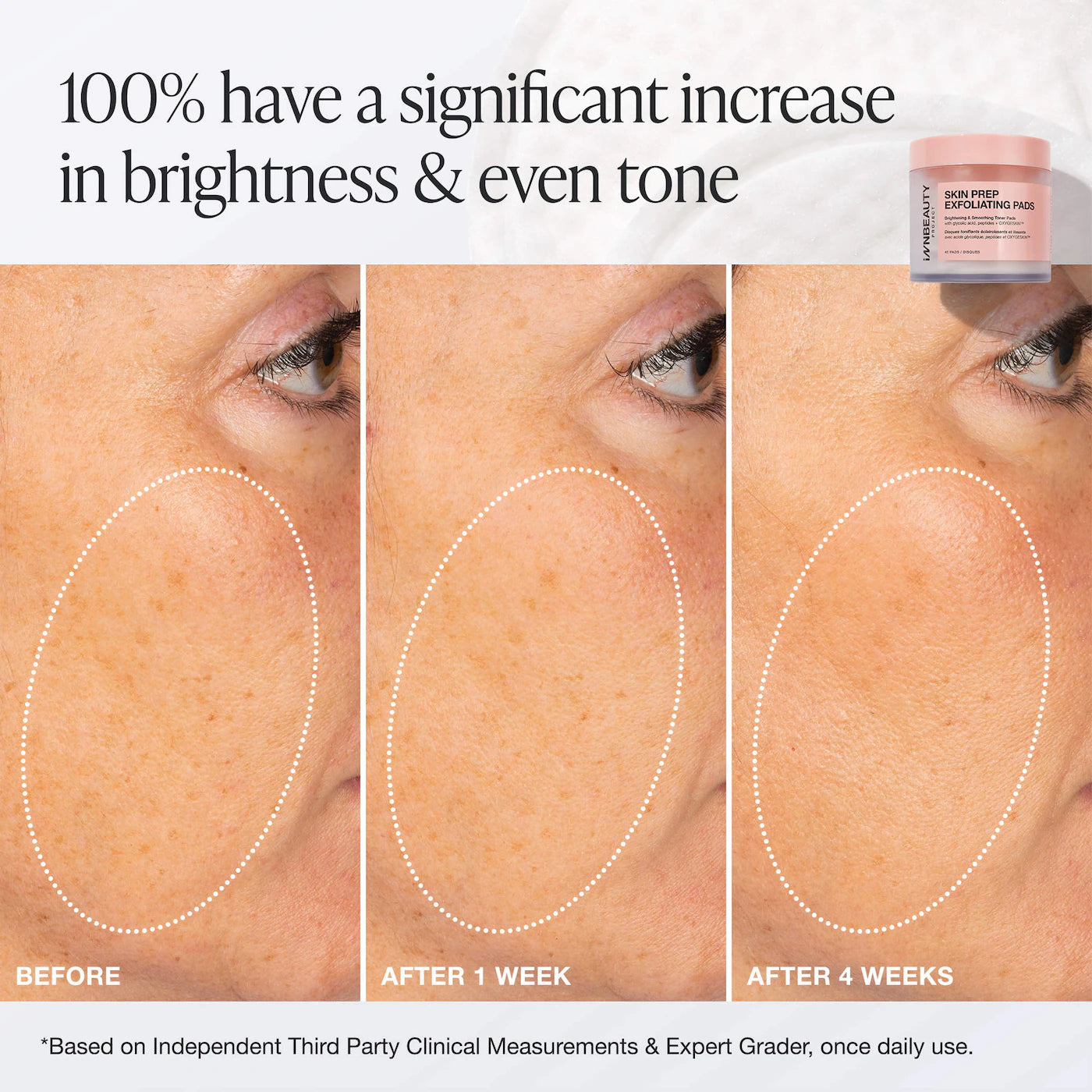 Skin Prep Exfoliating Pads