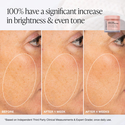 Skin Prep Exfoliating Pads