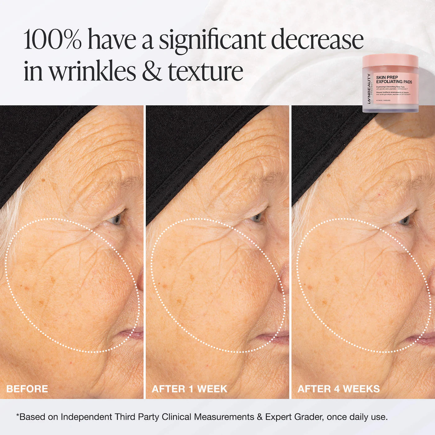 Skin Prep Exfoliating Pads