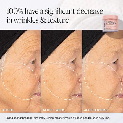 Skin Prep Exfoliating Pads