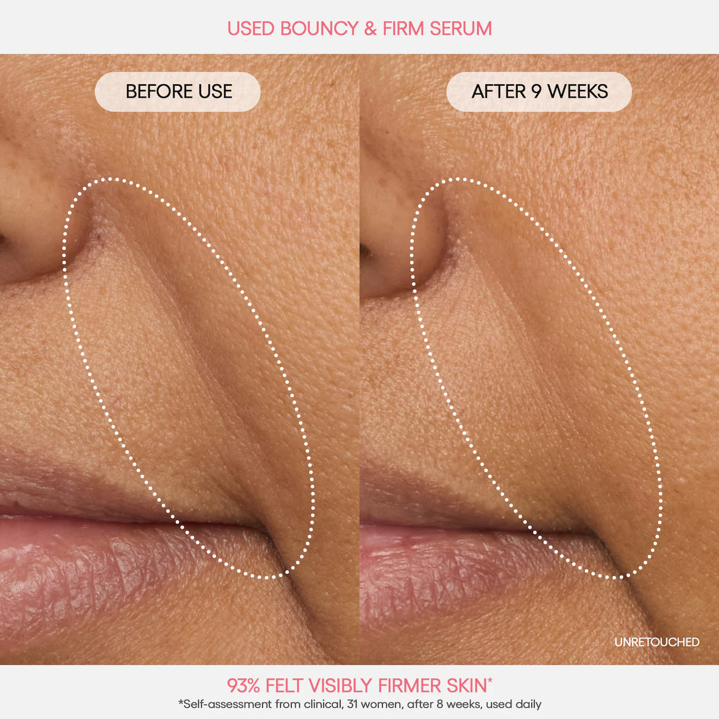 Bouncy Skin On the Go Set