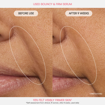 Bouncy Skin On the Go Set