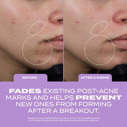 Dark Spot Milky Serum