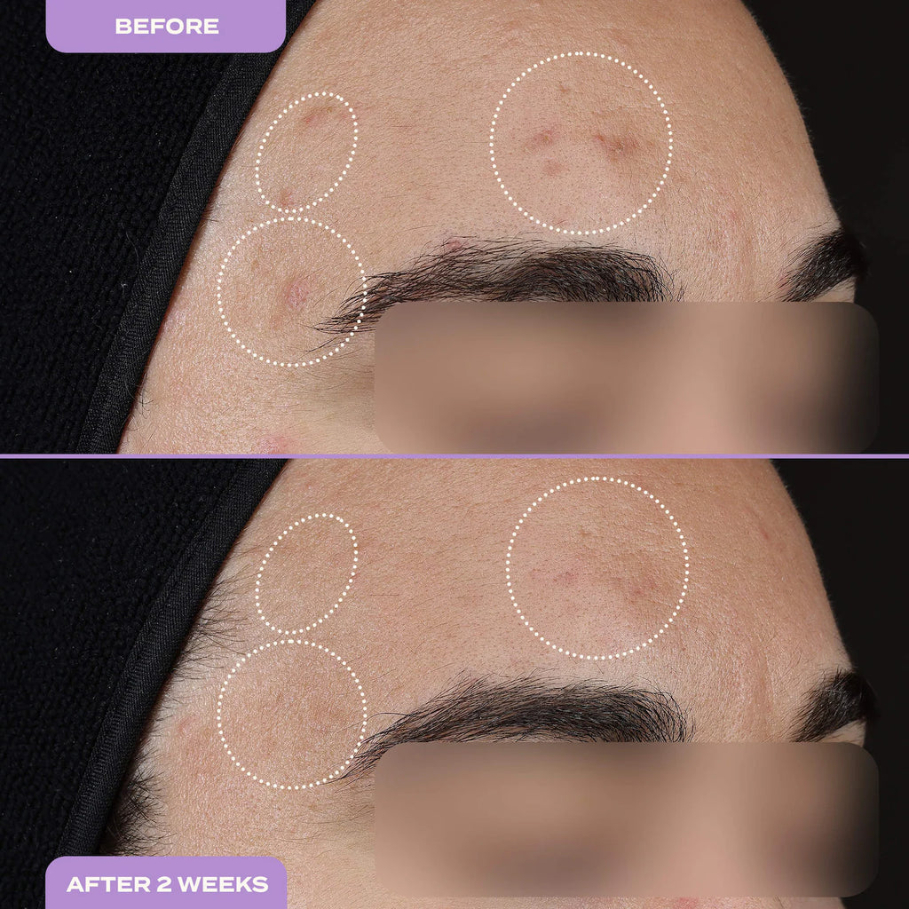 Dark Spot Milky Serum