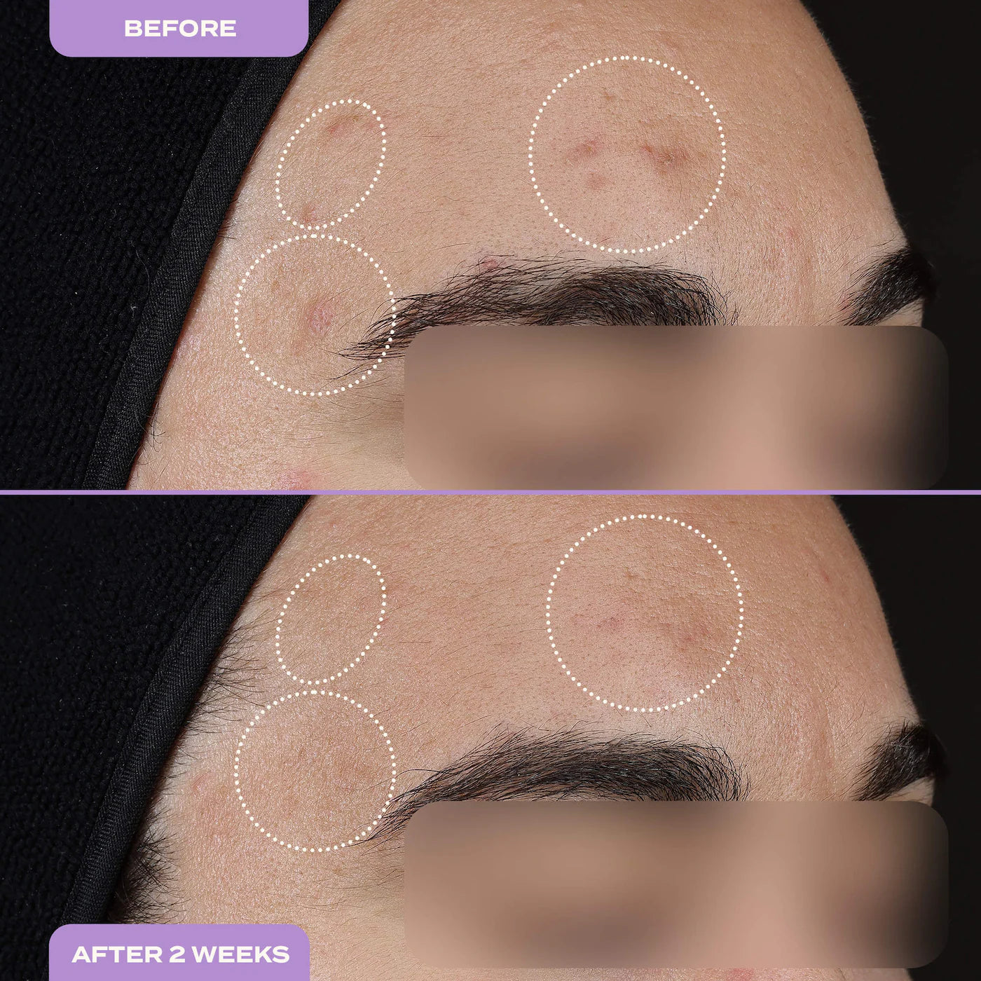 Dark Spot Milky Serum
