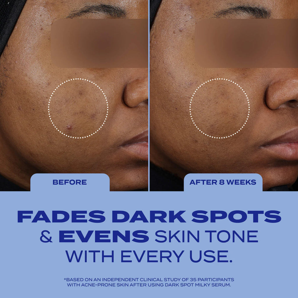 Dark Spot Milky Serum