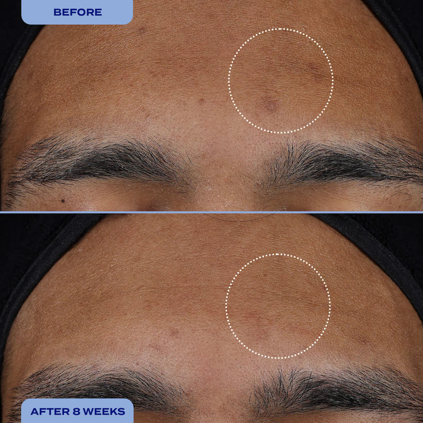 Dark Spot Milky Serum