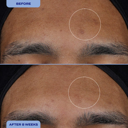 Dark Spot Milky Serum