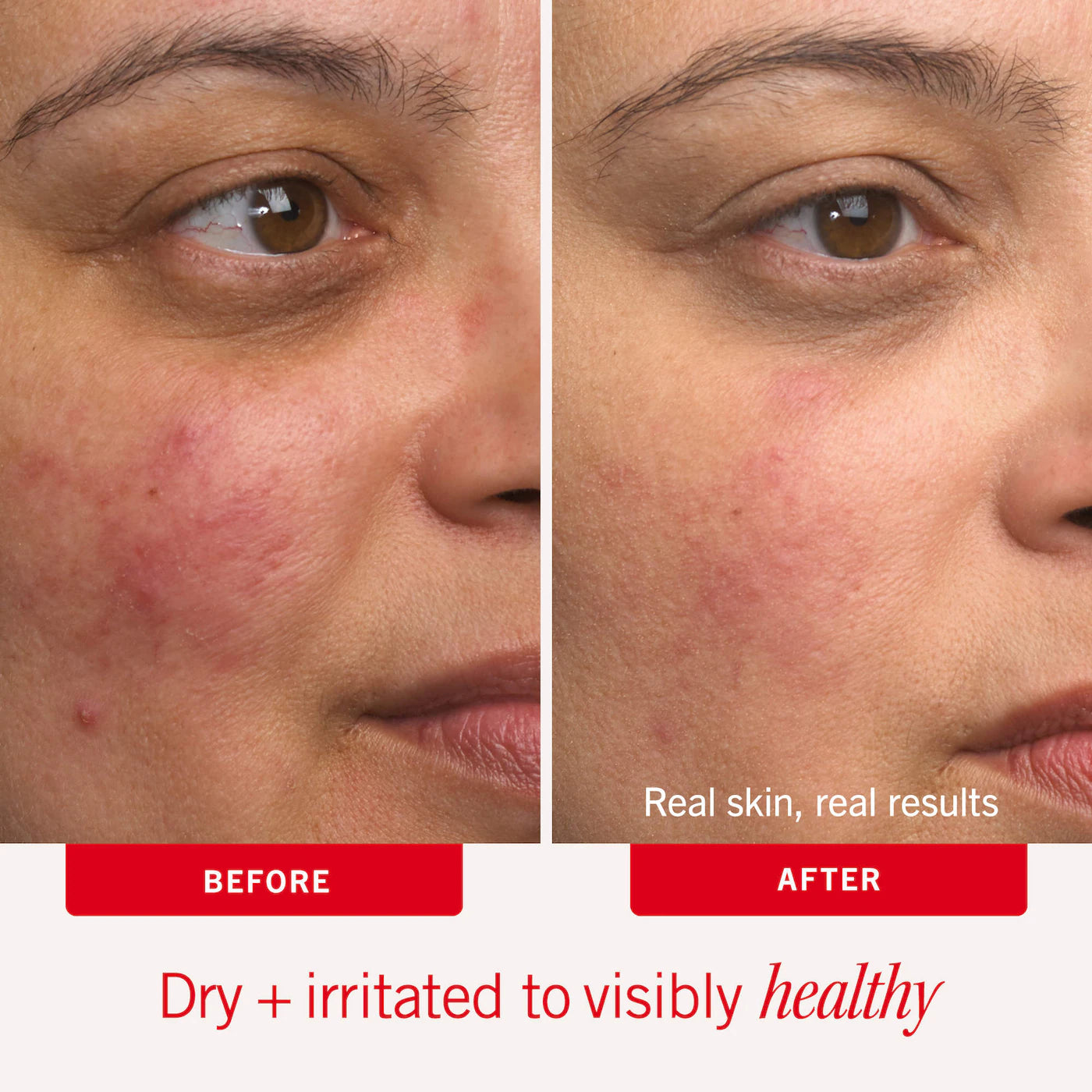 Ultra Repair® Cream Intense Hydration