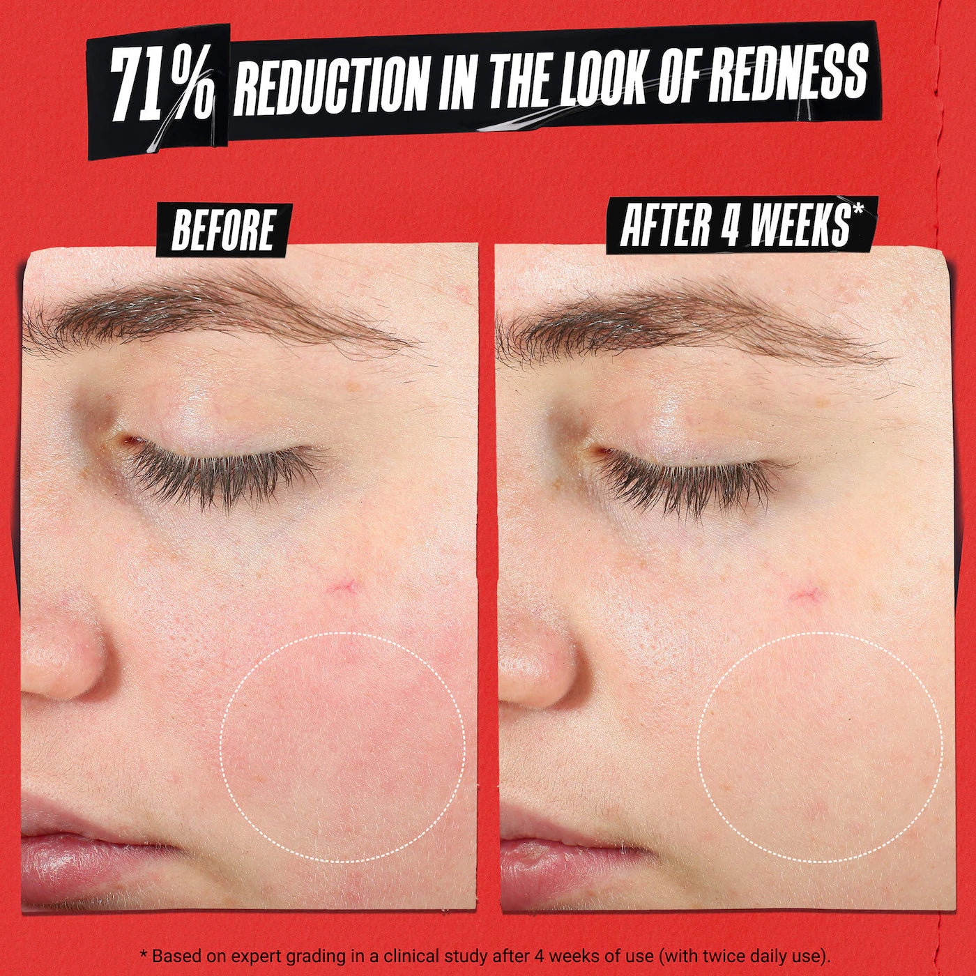 Ultra Facial Meltdown Recovery Cream