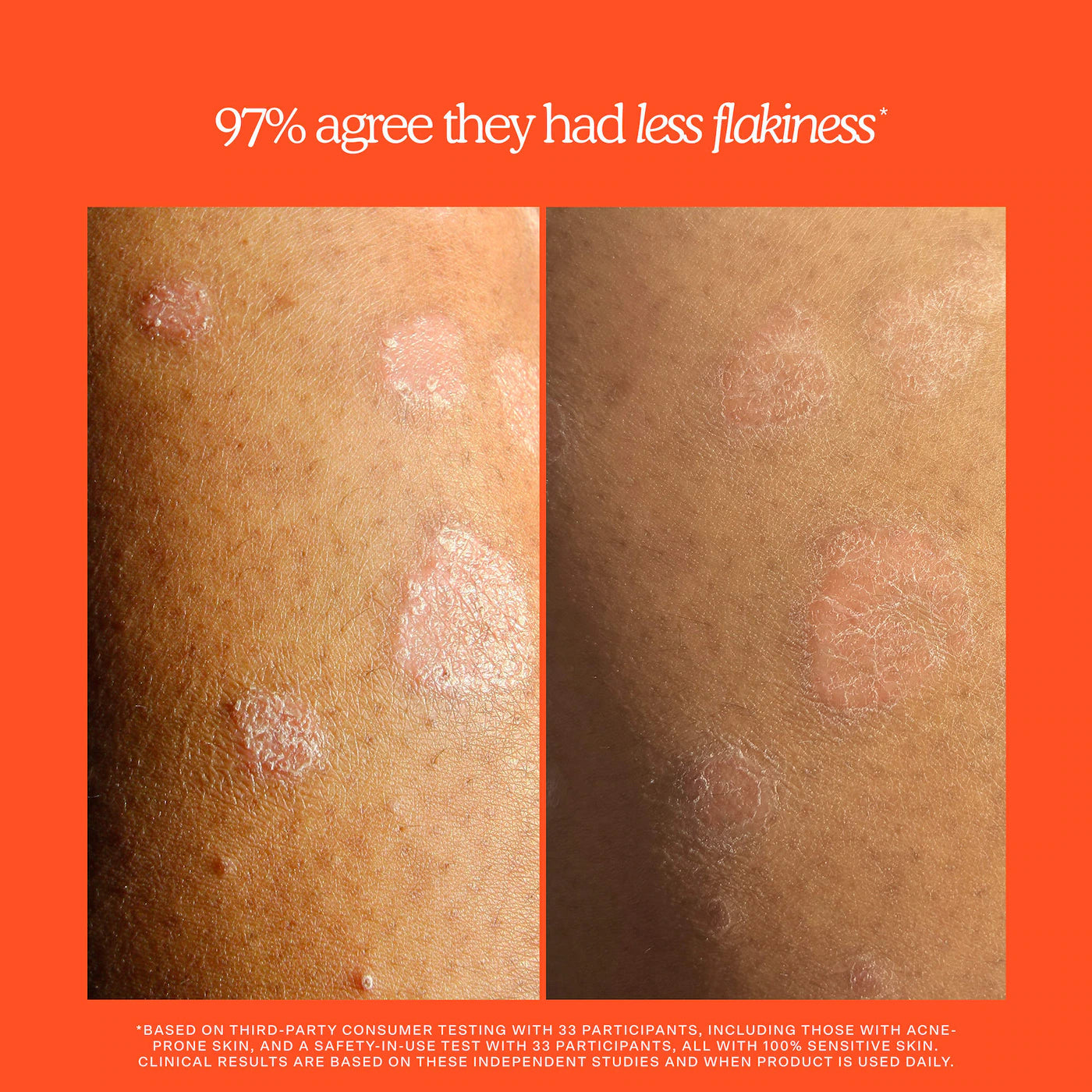SOS Rescue + Relief Body Wash Treatment