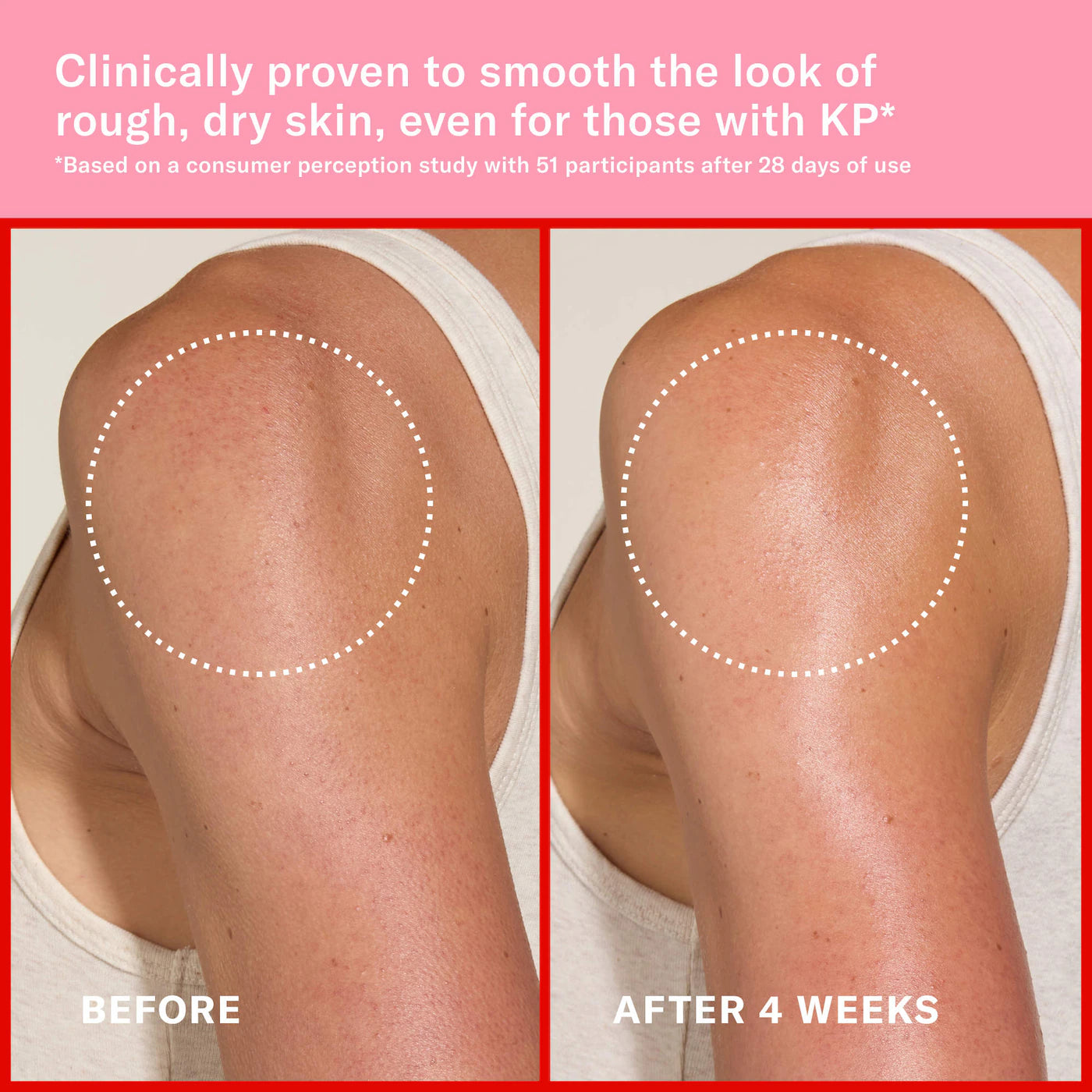 Pink Algae Pro-Retinol Body Butter