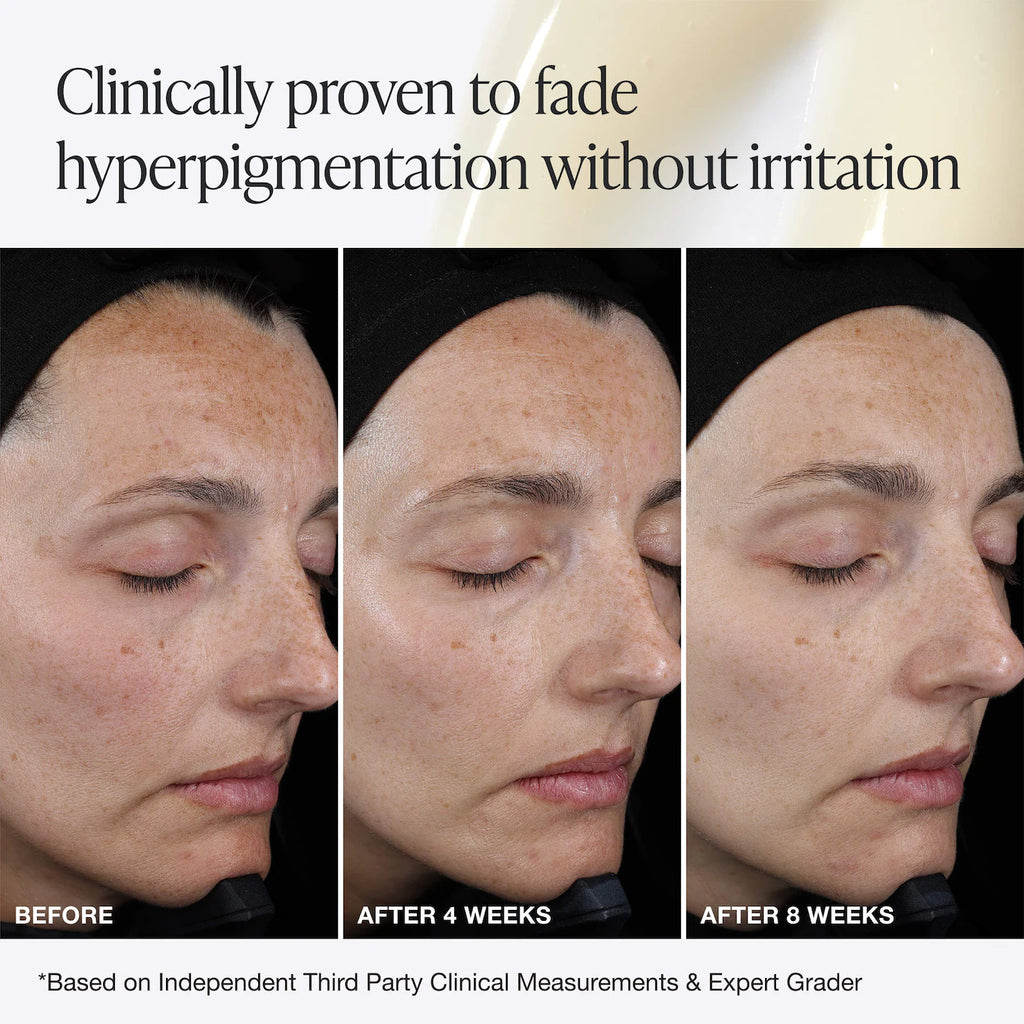 Pro C Serum Brightening Solution